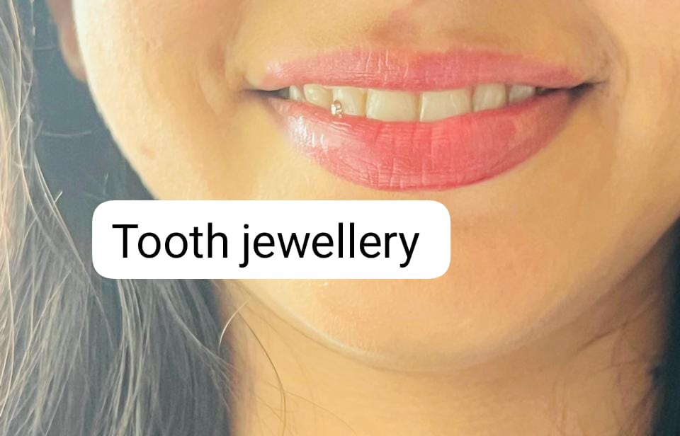 Tooth Jewellery